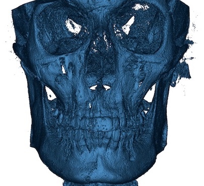 FME_Case_01