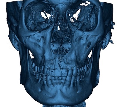 FME_Case_02